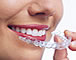 ZAHNSPANGEN / ORTHODONTIE Orthodontie / Zahnspangen